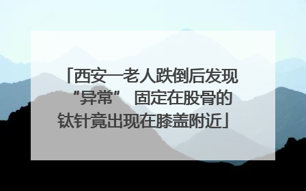 西安一老人跌倒后发现“异常” 固定在股骨的钛针竟出现在膝盖附近